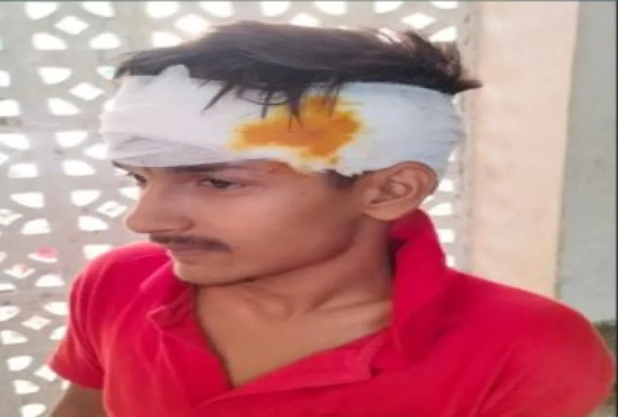 बलिया: स्कूल से लौट रहे किशोर पर 10-15 लोगों ने किया हमला, आरोपियों की तलाश में जुटी पुलिस