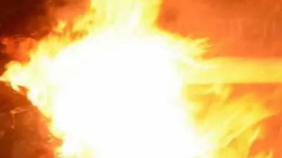 Raebareli News:रायबरेली में महिला ने युवक पर पेट्रोल डालकर लगाई आग, गंभीर अवस्था में ट्रामा सेंटर रेफर 