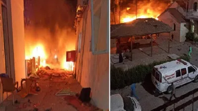 Hospital attack in Gaza:  बिना एनेस्थीसिया, फर्श पर लिटाकर घायलों की सर्जरी करने को मजबूर डाक्टर