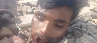 बलिया : रेलवे ट्रैक पर मिला युवक का शव, धड़ से सिर अलग ; शिनाख्त में कों मदद