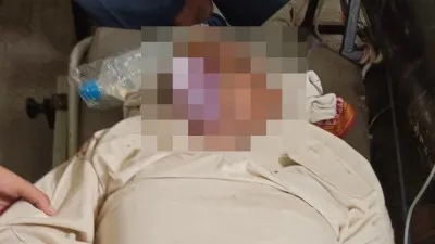 Ayodhya Road Accident: सड़क दुर्घटना में घायल हुए सपा नेता, ट्रामा सेंटर लखनऊ रेफर