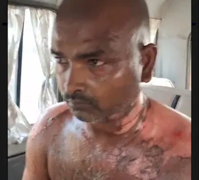 Ballia News: बड़े भाई की हरकत से बढ़ा विवाद, छोटे भाई की हालत गंभीर, जिला अस्पताल से रेफर