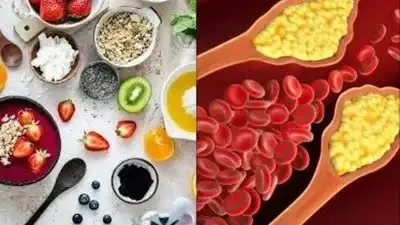 हाई कोलेस्ट्रॉल को कहें अलविदा: ये 3 हेल्दी ब्रेकफास्ट करेंगे कमाल