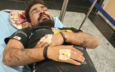 बलिया में तीन जगह मारपीट, आठ घायल; दो आरोपी गिरफ्तार