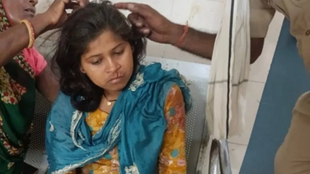 Bahraich News: खेत गई युवती पर तेंदुए का हमला, ग्रामीणों की सतर्कता से बची जान; अस्पताल में भर्ती