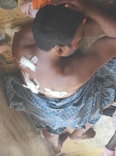 बलिया: मिठाई बनाने के बहाने बुलाया, बाइक सवार तीन युवकों ने हलवाई को चाकू से किया घायल