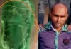 हरदोई: सांप के डसने के बाद जिंदा सांप को बोतल में लेकर मेडिकल कॉलेज पहुंचा युवक, इलाज के दौरान मौत