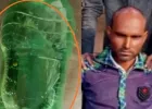 हरदोई: सांप के डसने के बाद जिंदा सांप को बोतल में लेकर मेडिकल कॉलेज पहुंचा युवक, इलाज के दौरान मौत