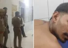 बलिया में युवक पर जानलेवा हमला, पीठ में लगी दो गोलियां; कई संदिग्ध हिरासत में