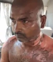 Ballia News: बड़े भाई की हरकत से बढ़ा विवाद, छोटे भाई की हालत गंभीर, जिला अस्पताल से रेफर