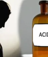 बरेली में शादी का दबाव बनाने का आरोप, युवती ने तेजाब पिया; तीन पर मुकदमा