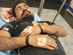 बलिया में तीन जगह मारपीट, आठ घायल; दो आरोपी गिरफ्तार