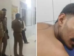 बलिया में युवक पर जानलेवा हमला, पीठ में लगी दो गोलियां; कई संदिग्ध हिरासत में