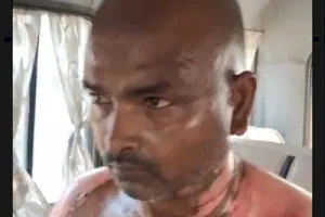 Ballia News: बड़े भाई की हरकत से बढ़ा विवाद, छोटे भाई की हालत गंभीर, जिला अस्पताल से रेफर