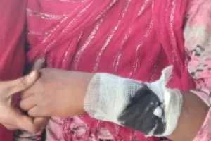 पारिवारिक विवाद में भाभी ने ननद पर किया चाकू से हमला, मुकदमा दर्ज