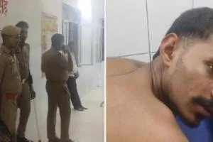 बलिया में युवक पर जानलेवा हमला, पीठ में लगी दो गोलियां; कई संदिग्ध हिरासत में