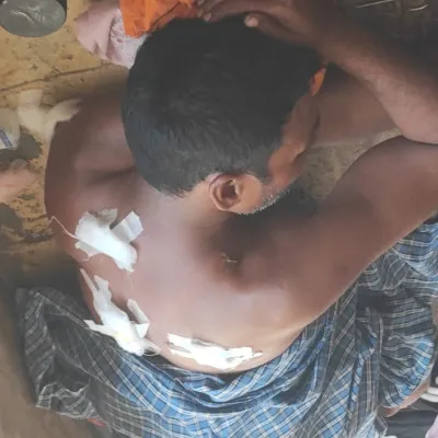 बलिया: मिठाई बनाने के बहाने बुलाया, बाइक सवार तीन युवकों ने हलवाई को चाकू से किया घायल